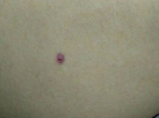 癌细胞爱“吃糖”吗？医生呼吁：这6物，建议少吃点