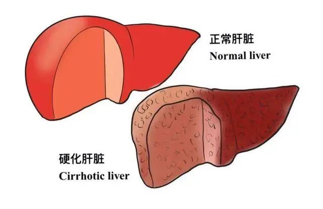 高血脂能吃豆腐吗？医生：6种降脂食物常吃，血脂或会悄悄下降