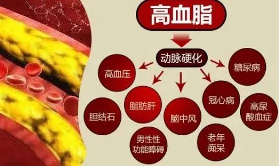 血脂高的人或是面条吃多了？建议：想降脂的人，2种食物最好少吃