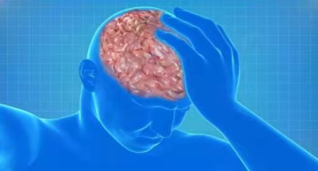 脑梗死越来越多，哈佛大学医学院：坚持做到这3件事，远离脑梗