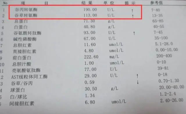 转氨酶高，不能吃西瓜？医生：喝4茶，吃2果，肝或“感激”你