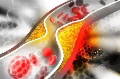 “高胆固醇”食物或被发现，鸡蛋上榜？医生：这几种还是少吃为好