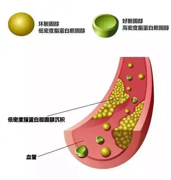 “高胆固醇”食物或被发现，鸡蛋上榜？医生：这几种还是少吃为好