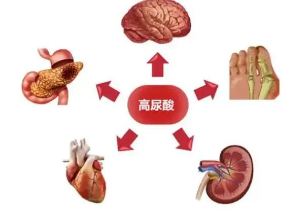 苦瓜可以降尿酸吗？医生：这5物才是降尿酸“高手”，建议吃些