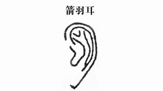 耳朵不同命不同？“穷人耳”“富人耳”有啥差别？你的耳朵是啥样