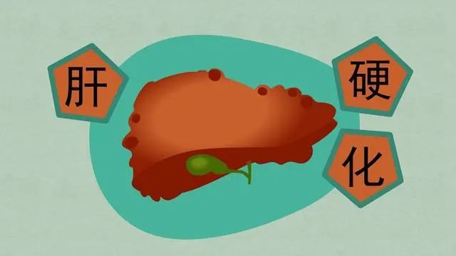 肝硬化，不能吃蜂蜜？医生提醒：真正不能吃的，是这4种食物