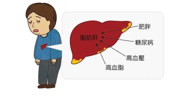 肝硬化，不能吃蜂蜜？医生提醒：真正不能吃的，是这4种食物
