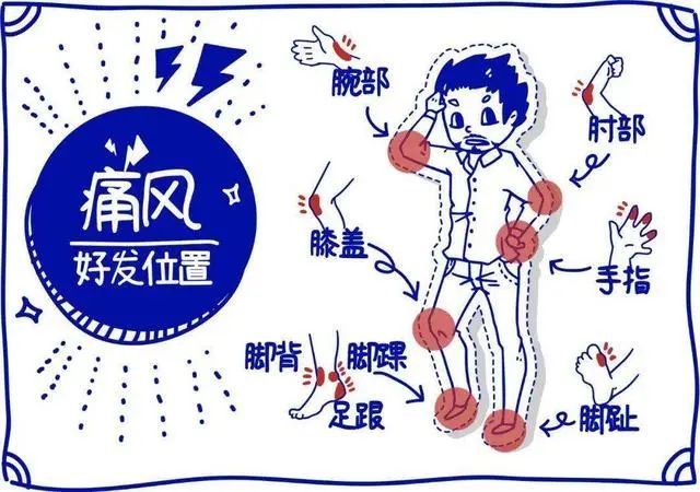 “嘌呤大户”被揪出，医生：经常吃对身体或有这些危害