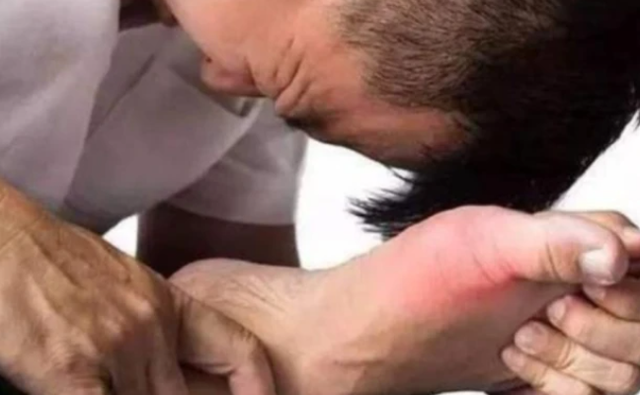 尿酸高的人，3种水果尽量少碰，你知道是哪三种吗？来看看吧