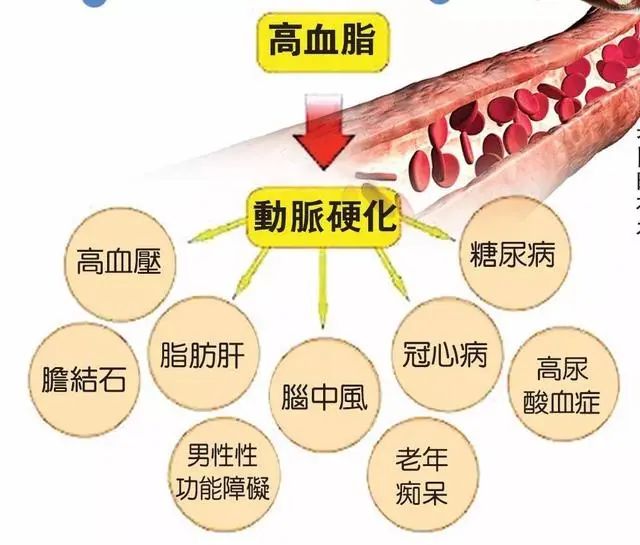 每天喝一杯牛奶对血脂到底有哪些影响？建议大家早了解