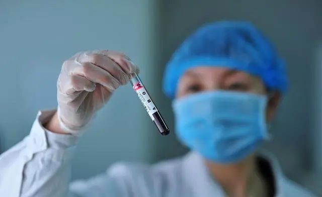 “甘油三酯大户”公布，医生：能不吃就不吃，别等血管堵塞才着急