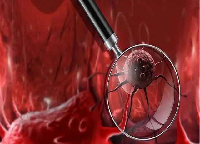 糖是癌细胞的“加速剂”吗？真正加速细胞癌变的是这5种食物