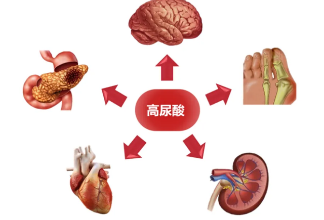 排名第一的“降酸王”被发现，并非芹菜，坚持吃，或会远离痛风