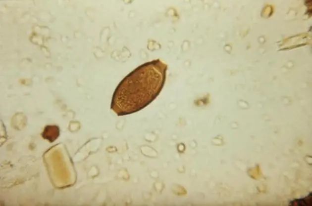 含有“寄生虫”的四种食物，医生建议尽量少吃，早了解早好