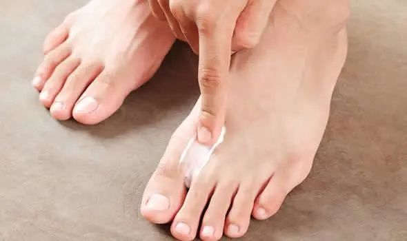 脚后跟干裂，并非是皮肤缺水所致，或许有其他原因