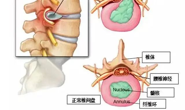 为何中老年人小腿外侧总是酸胀、麻木，不出意外，这种可能性最大