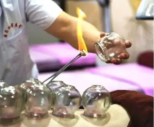 拔火罐吸出来的瘀血，是体内的毒素吗？不妨来了解