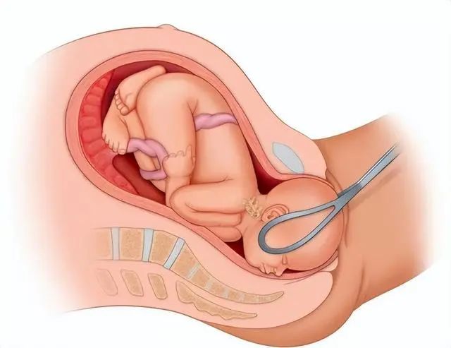 子宫“不欢迎”六种水果，女性尽量少吃，子宫疾病应该如何预防？