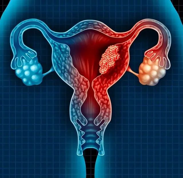 子宫“不欢迎”六种水果，女性尽量少吃，子宫疾病应该如何预防？