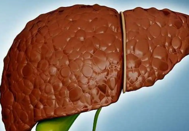 3种“假蔬菜”，或比酒精还伤肝，不忌口，应小心肝脏被“掏空”