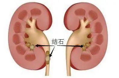 常喝“豆浆”好处多？但医生强调：这5类人却不适合喝，早看早知