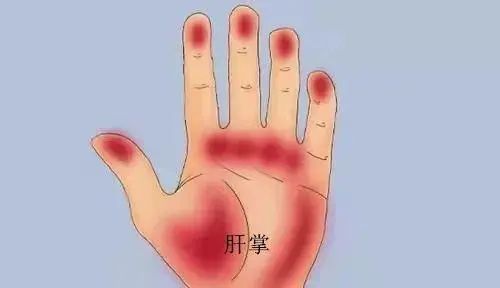 韭菜，真的是肝病的“催化剂”吗？不妨了解下
