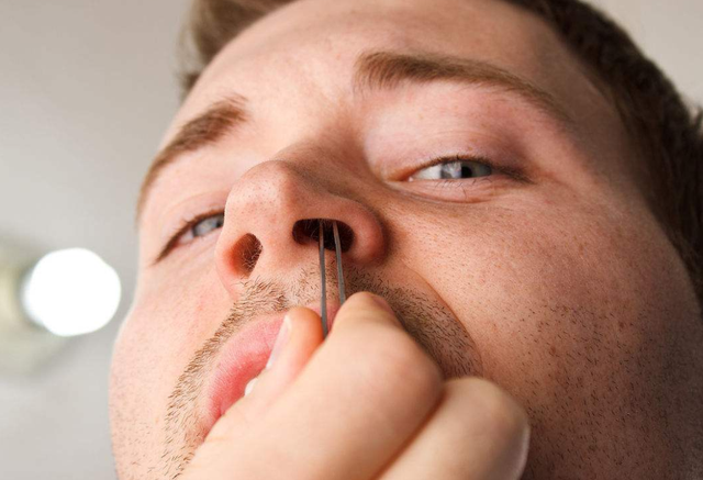 男性的鼻毛为何会“窜”出来？鼻毛旺盛说明了啥？早知道早受益
