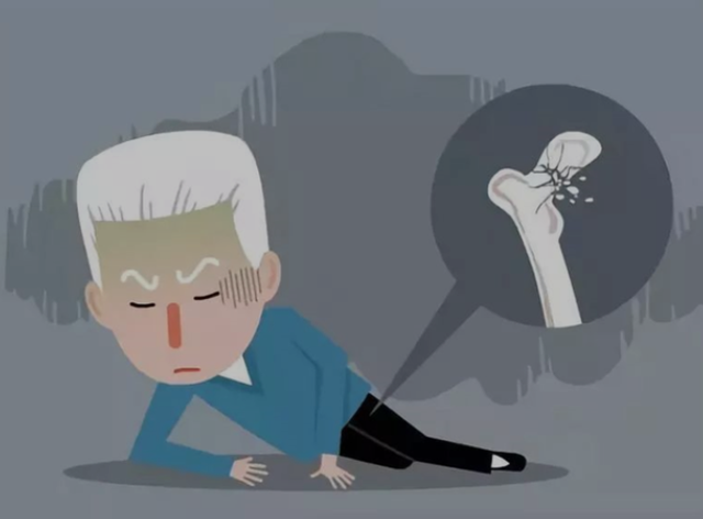 老年人摔一跤，结果有多严重？过了60岁，3种食物不要不舍得吃