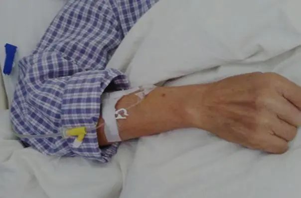 老年人摔一跤，结果有多严重？过了60岁，3种食物不要不舍得吃
