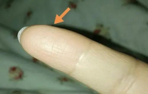 气血不足百病生！建议：常吃8物，或有助补气养血，“面若桃花”