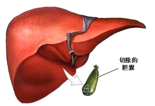 长期吃花生，会刺激癌症扩散吗？涨知识的科普，不妨转给家人一看