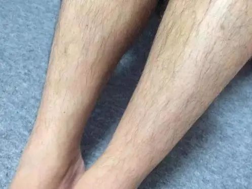 为什么有的女性体毛旺盛，有的却体毛较少？看完可能就明白了