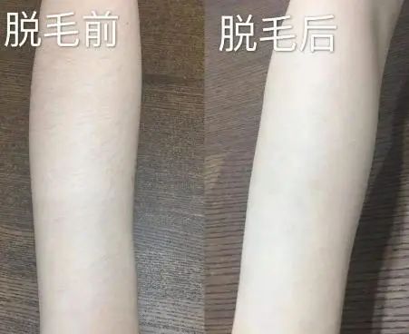 为什么有的女性体毛旺盛，有的却体毛较少？看完可能就明白了