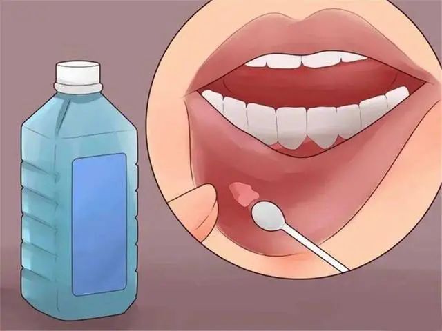 莴笋是新的“抗癌一霸”？医生提醒：莴笋别乱吃，有3类人不合适