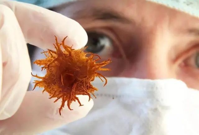 “癌细胞”最不喜欢5种“食品”？平时常吃，或让癌细胞远离你