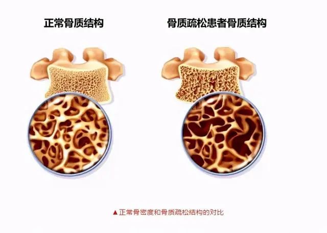长期吸烟却又坚持喝茶的人，后来都怎么样了？医生说出答案