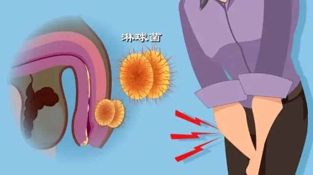 9种病能通过“性传播”你清楚几个？思想开放的人，建议了解一下