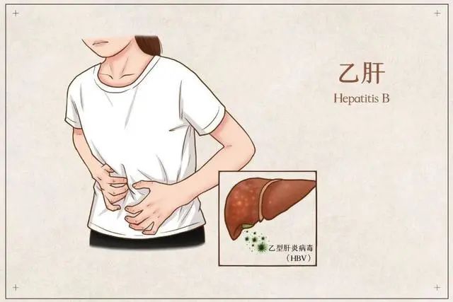 9种病能通过“性传播”你清楚几个？思想开放的人，建议了解一下