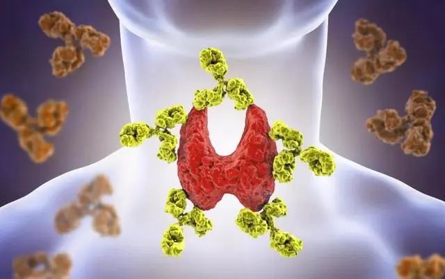 甲状腺结节，不能碰“羊肉汤”？医生：保护甲功，3类早餐应少吃