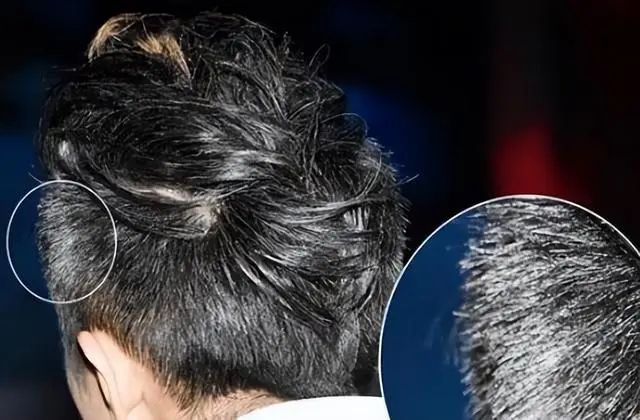白发长在哪，病就出在哪？长在前额、后脑勺，两鬓，分别代表什么
