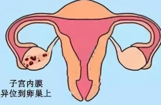 绝经不一定是坏事！妇科主任：绝经后，三个健康问题或不告而别