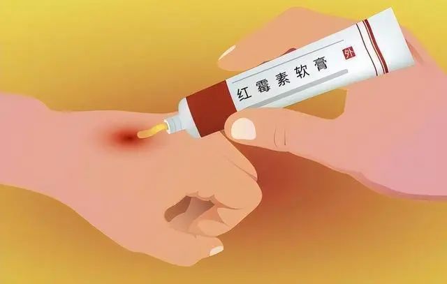 红霉素软膏，在眼部涂两下，身体会发生什么变化？可以了解一下