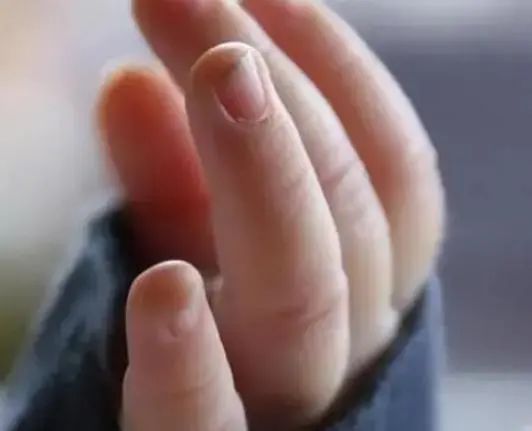 从小“咬指甲”的孩子，长大后怎样了？医生：一般逃不掉5种结局