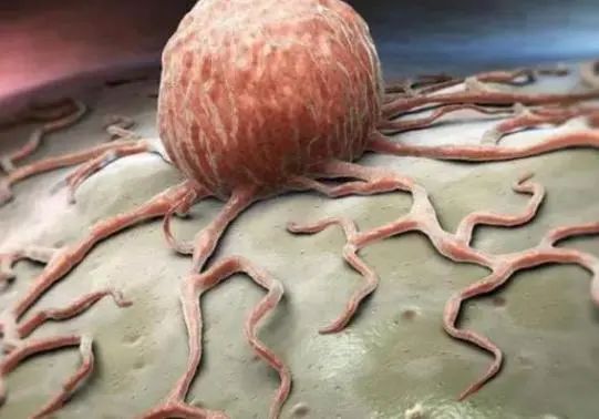 鱼是发物不能吃，癌症需忌口？提醒：真正不能吃的是这3种食物