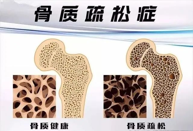 血压高，不能吃“韭菜”吗？医生：控血压，4种素食请撤下饭桌