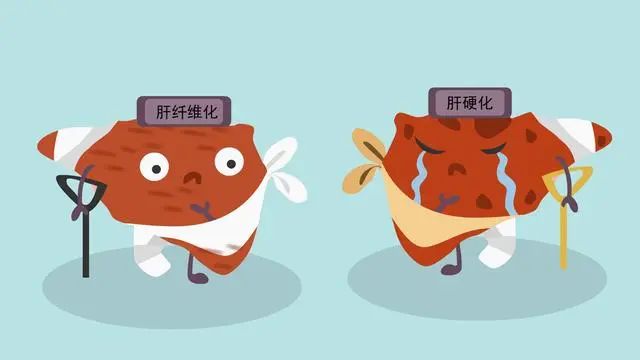 肝开始变硬，头部会有3个异常，若一个也没有，说明肝脏还很健康