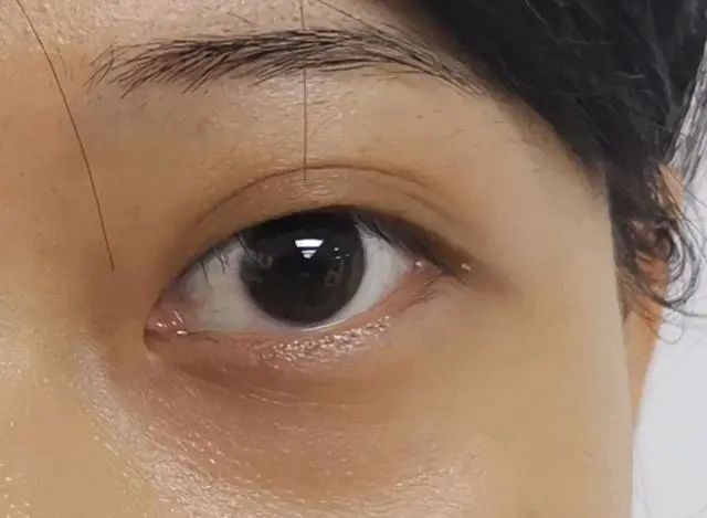 肝开始变硬，头部会有3个异常，若一个也没有，说明肝脏还很健康