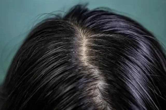 肝开始变硬，头部会有3个异常，若一个也没有，说明肝脏还很健康