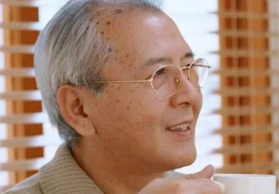 为何老人身上爱长斑？建议：50岁后坚持五个习惯，或可减轻老年斑