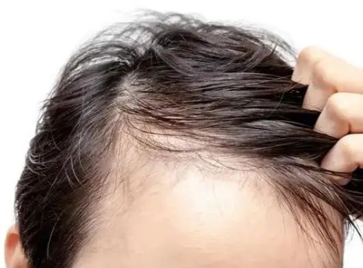 “6甜”伤肝，要少吃，“4酸”养肝，可常吃，吃对肝才能变好